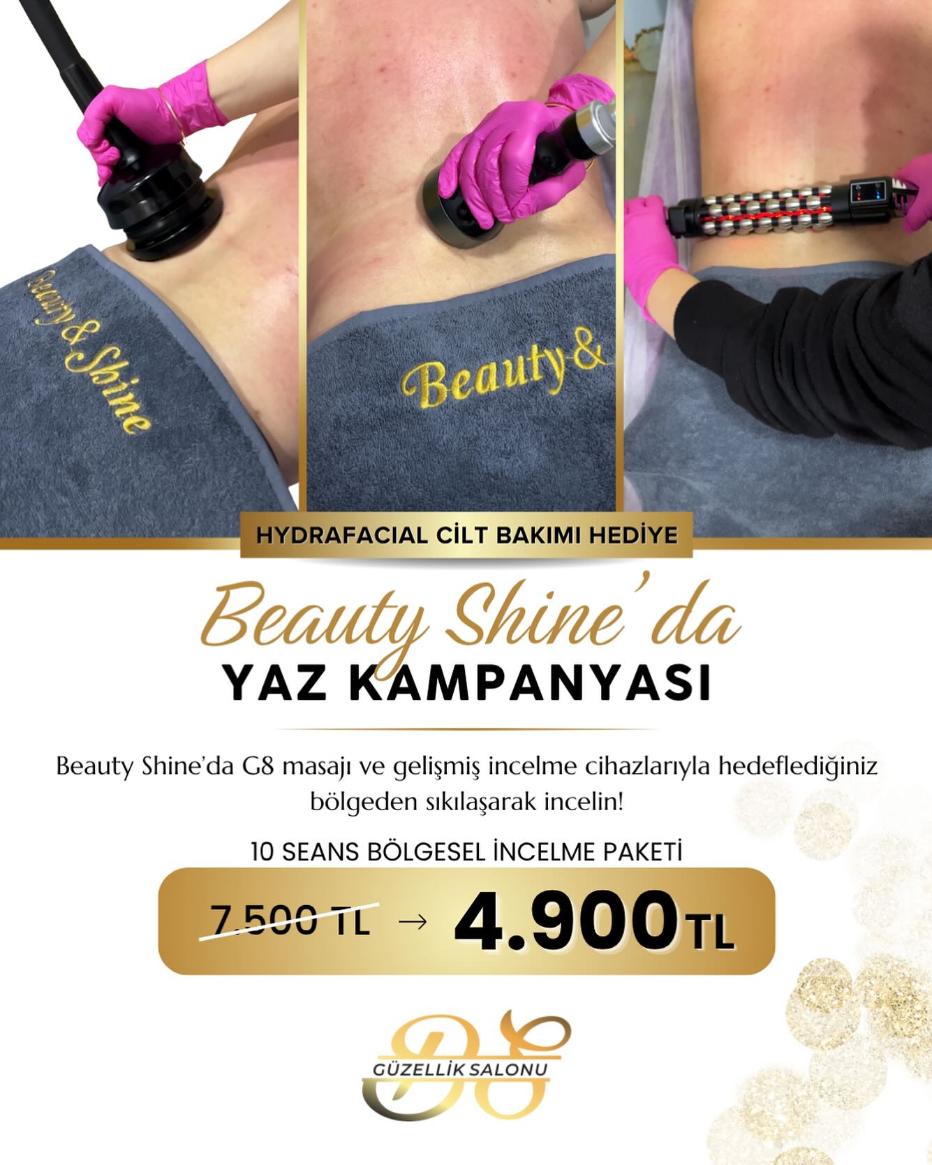 Afyonkarahisar'da Beauty Shine'dan Yaz Kampanyası: Bölgesel İncelme Paketi Sadece 4.900 TL