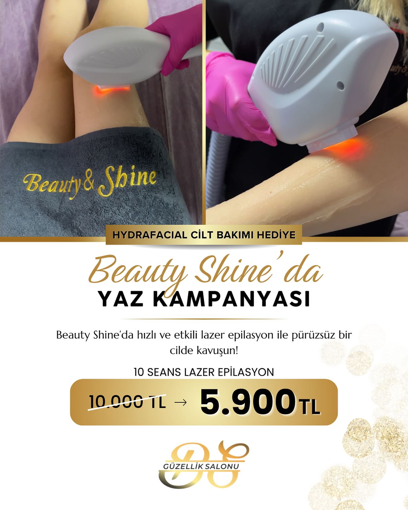 Afyonkarahisar'da Yaz Kampanyası: Beauty Shine'dan Lazer Epilasyon Fırsatı